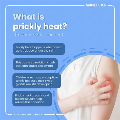 How to Prevent and Treat Prickly Heat or Bungang Araw .